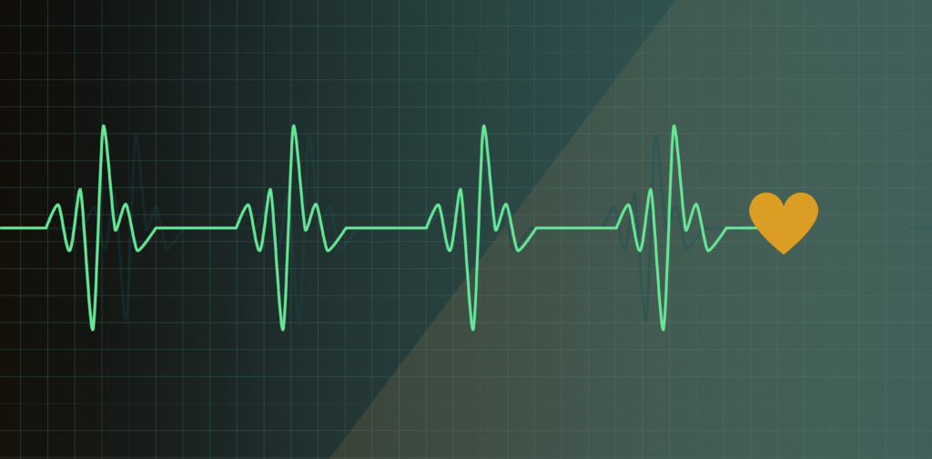 illustration d'un électrocardiogramme
